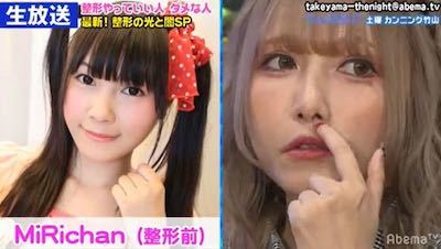 約900万円で10カ所を整形した女性の実年齢に衝撃「みえない！」