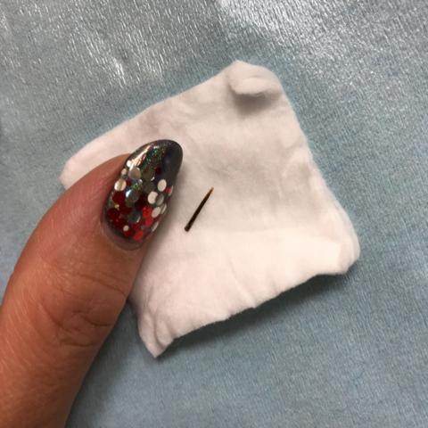 キンタロー悩むも病院行った結果