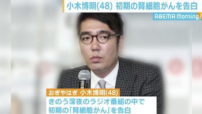 おぎやはぎ小木博明、ステージ1「腎細胞がん」告白 一時療養へ