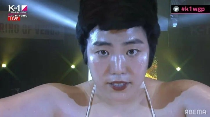 ゆりやんの胸に貼られた“黒いテープ”に騒然