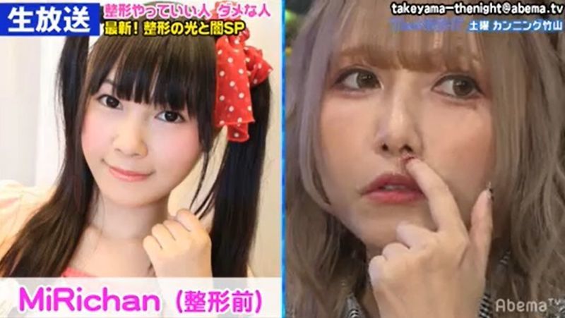 約900万円で10カ所を整形した女性の実年齢に衝撃「みえない！」